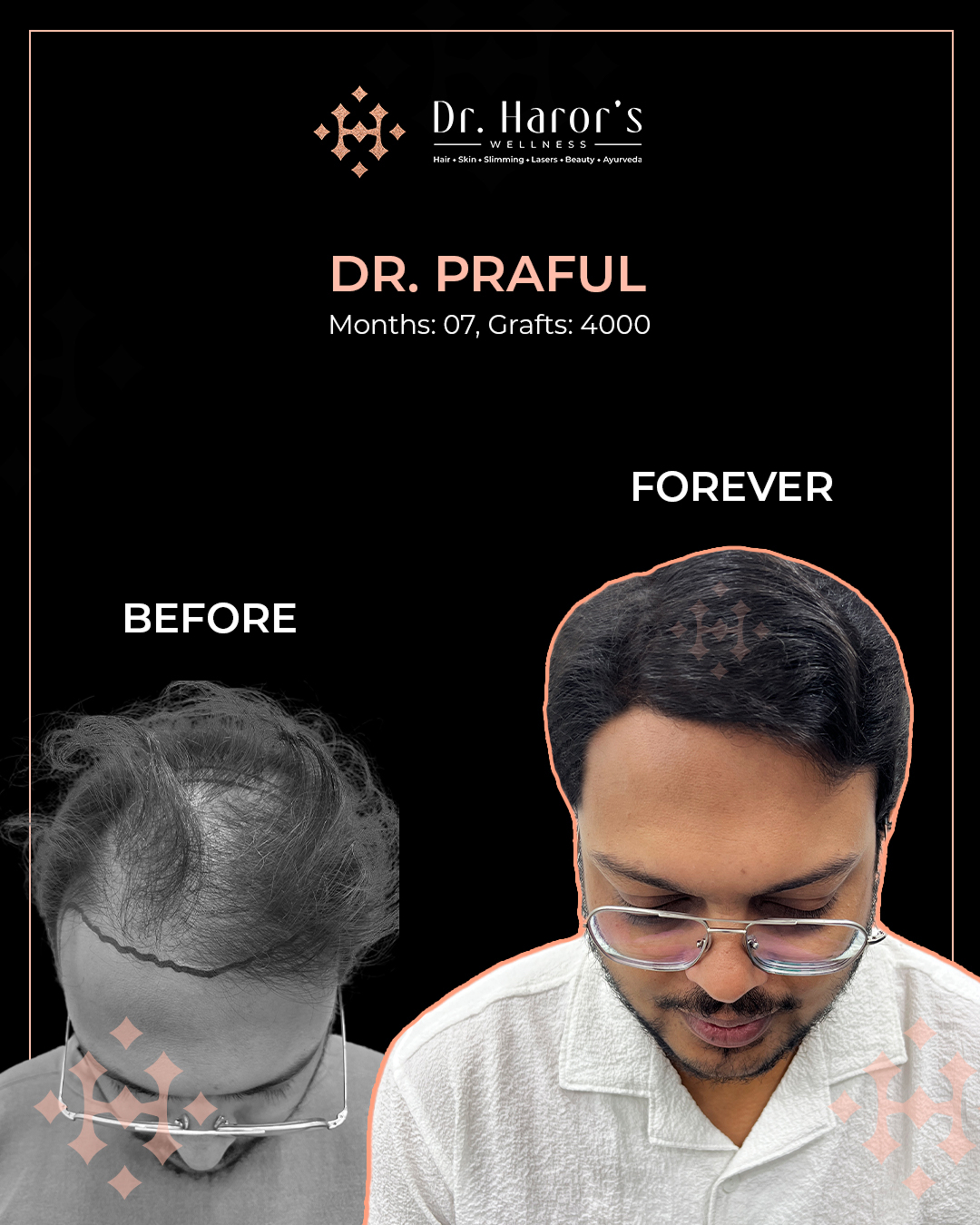 6 - Before and After